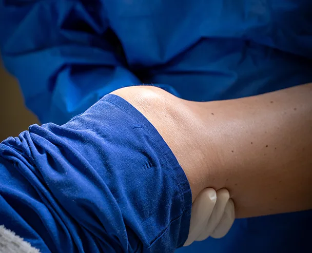 MAKO Robotic Surgery | Dr David Kitchen